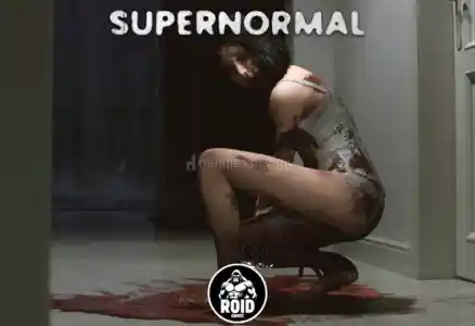 Supernormal Steam Hesabı | OtoGuard Sistemi